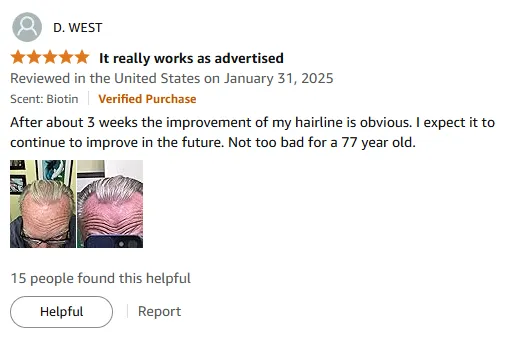 My Hairline Improved in 3 Weeks with This Shampoo