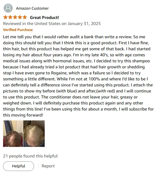 My Thin Hair Growth Success with This Shampoo