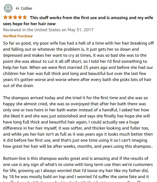 My Wife's Hair Regrowth with Effective Shampoo