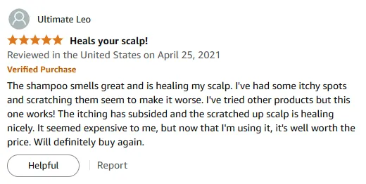 My Healing Shampoo Review for Itchy Scalp Relief