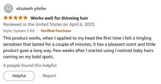 Nioxin Works: My Thinning Hair Growth