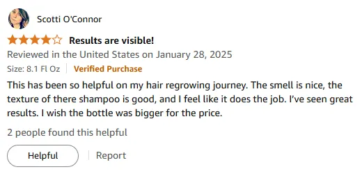My Nioxin Shampoo Results: Hair Regrowth Help
