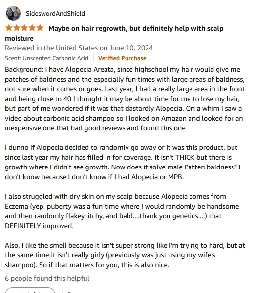 I Beat Alopecia with Carbonic Acid Shampoo
