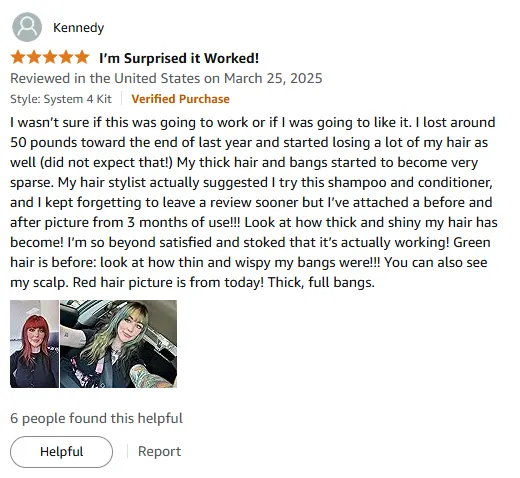 I Used Nioxin for Hair Loss and It Works