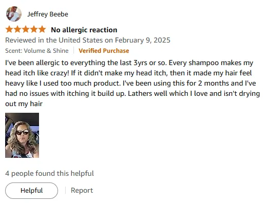 I Found a Gentle Hydrating Shampoo for Itchy Scalp