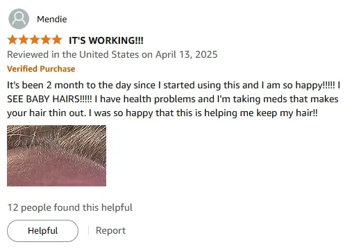 My Baby Hairs Thrived with This Thinning Hair Solution